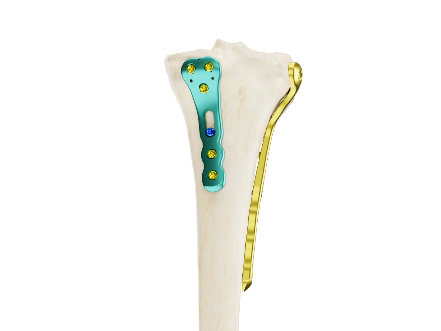 Affinity Tibia Proximal - Imagen 3