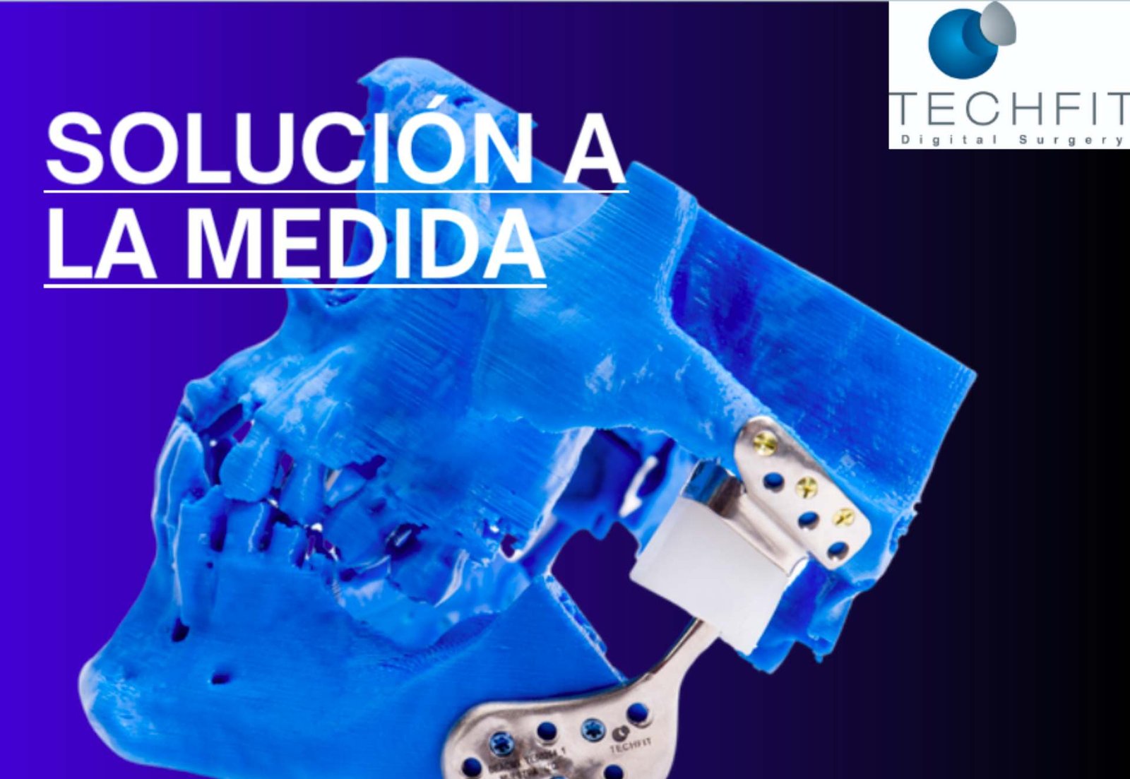 solucion a la medida sampedro